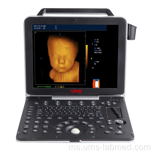Pengimbas Ultrasound 4D Doppler Warna Mudah Alih UW-P6